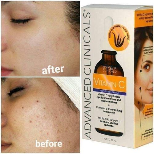 Advanced clinicals Vitamin C Anti-aging Serum For Dark Spots - 52ml