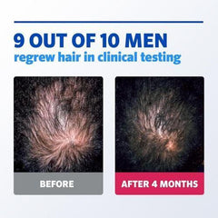 Rogaine Men's 5% Minoxidil Hair Regrowth Treatment Foam 3 Month Supply 3X60g