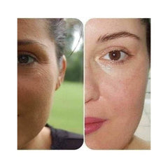 St Ives Renewing Collagen Elastin Moisturizer - 283 G