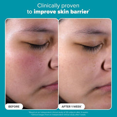 PAULA'S CHOICE Skin Perfecting 2% BHA Liquid Salicylic Acid Exfoliant 30 ml